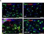 Rat IgG (H+L) Cross-Adsorbed Secondary Antibody in Immunocytochemistry (ICC/IF)