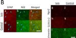 Mouse IgG (H+L) Cross-Adsorbed Secondary Antibody in Immunocytochemistry (ICC/IF)