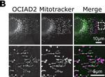 Rabbit IgG (H+L) Highly Cross-Adsorbed Secondary Antibody in Immunocytochemistry (ICC/IF)