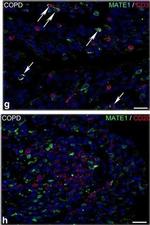 Mouse IgG (H+L) Cross-Adsorbed Secondary Antibody in Immunohistochemistry (IHC)