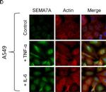 Mouse IgG (H+L) Cross-Adsorbed Secondary Antibody in Immunocytochemistry (ICC/IF)