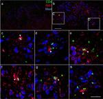 Rat IgG (H+L) Highly Cross-Adsorbed Secondary Antibody in Immunohistochemistry (IHC)