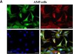 Mouse IgG (H+L) Cross-Adsorbed Secondary Antibody in Immunocytochemistry (ICC/IF)