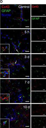 Mouse IgG (H+L) Cross-Adsorbed Secondary Antibody in Immunocytochemistry (ICC/IF)