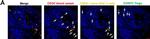 Mouse IgG (H+L) Cross-Adsorbed Secondary Antibody in Immunohistochemistry (IHC)