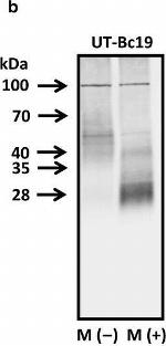 Mouse IgG (H+L) Secondary Antibody in Western Blot (WB)