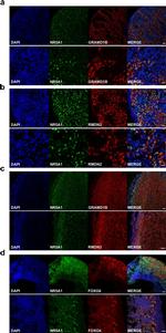 Rabbit IgG (H+L) Highly Cross-Adsorbed Secondary Antibody in Immunohistochemistry (IHC)