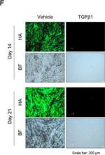 Mouse IgG (H+L) Cross-Adsorbed Secondary Antibody in Immunocytochemistry (ICC/IF)