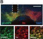 Mouse IgG (H+L) Cross-Adsorbed Secondary Antibody in Immunohistochemistry (IHC)