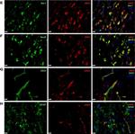 Mouse IgG (H+L) Highly Cross-Adsorbed Secondary Antibody in Immunohistochemistry (IHC)