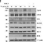 Rabbit IgG (H+L) Cross-Adsorbed Secondary Antibody in Western Blot (WB)