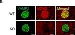 Rabbit IgG (H+L) Secondary Antibody in Immunohistochemistry (IHC)