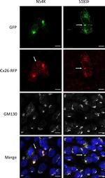 Rabbit IgG (H+L) Highly Cross-Adsorbed Secondary Antibody in Immunocytochemistry (ICC/IF)