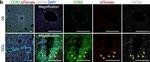 Rabbit IgG (H+L) Highly Cross-Adsorbed Secondary Antibody in Immunohistochemistry (PFA fixed) (IHC (PFA))