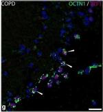 Mouse IgG (H+L) Cross-Adsorbed Secondary Antibody in Immunohistochemistry (IHC)