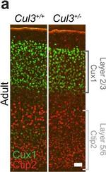 Mouse IgG (H+L) Cross-Adsorbed Secondary Antibody in Immunocytochemistry (ICC/IF)