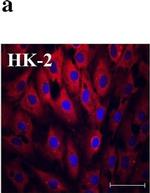 Rabbit IgG (H+L) Highly Cross-Adsorbed Secondary Antibody in Immunocytochemistry (ICC/IF)