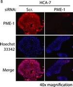 Mouse IgG (H+L) Cross-Adsorbed Secondary Antibody in Immunocytochemistry (ICC/IF)