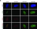 Rabbit IgG (H+L) Cross-Adsorbed Secondary Antibody in Immunocytochemistry (ICC/IF)