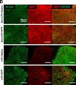 Mouse IgG (H+L) Cross-Adsorbed Secondary Antibody in Immunohistochemistry (IHC)