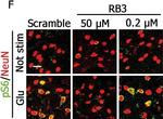 Mouse IgG (H+L) Cross-Adsorbed Secondary Antibody in Immunohistochemistry (IHC)