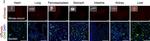 Rat IgG (H+L) Highly Cross-Adsorbed Secondary Antibody in Immunohistochemistry (PFA fixed) (IHC (PFA))