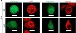 Mouse IgG (H+L) Cross-Adsorbed Secondary Antibody in Immunocytochemistry (ICC/IF)