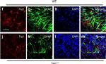 Mouse IgG (H+L) Cross-Adsorbed Secondary Antibody in Immunocytochemistry (ICC/IF)