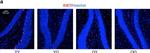 Rabbit IgG (H+L) Cross-Adsorbed Secondary Antibody in Immunohistochemistry (IHC)