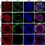 Mouse IgG (H+L) Cross-Adsorbed Secondary Antibody in Immunohistochemistry (IHC)