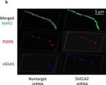 Mouse IgG (H+L) Highly Cross-Adsorbed Secondary Antibody in Immunocytochemistry (ICC/IF)