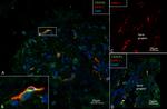 CX3CR1 Antibody in Immunohistochemistry (IHC)