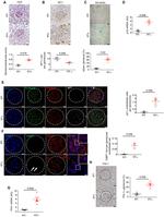 CD34 Antibody in Immunocytochemistry (ICC/IF)