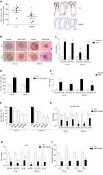 CD44 Antibody in Immunohistochemistry (IHC)