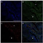 LYVE1 Antibody in Immunohistochemistry (IHC)