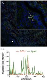 LYVE1 Antibody in Immunohistochemistry (IHC)