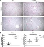 CD45 Antibody in Immunohistochemistry (IHC)