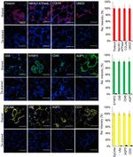 Cytokeratin 8 Antibody in Immunohistochemistry (IHC)