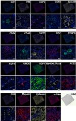 Cytokeratin 8 Antibody in Immunohistochemistry (IHC)