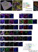 Cytokeratin 8 Antibody in Immunohistochemistry (IHC)