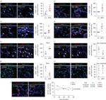 CD45 Antibody in Immunohistochemistry (IHC)