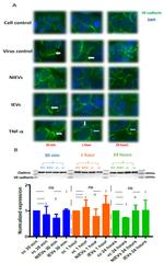 CD144 (VE-cadherin) Antibody in Western Blot (WB)