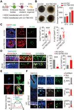 EOMES Antibody in Immunohistochemistry (IHC)