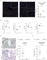 Endomucin Antibody in Immunocytochemistry (ICC/IF)