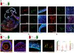 Ki-67 Antibody in Immunohistochemistry (Frozen) (IHC (F))