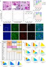 FOXP3 Antibody in Immunocytochemistry (ICC/IF)