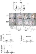 FOXP3 Antibody in Immunohistochemistry (IHC)