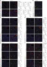 Endomucin Antibody in Immunocytochemistry (ICC/IF)