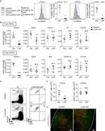 AIRE Antibody in Immunohistochemistry (IHC)