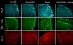 CD274 (PD-L1, B7-H1) Antibody in Immunohistochemistry (IHC)